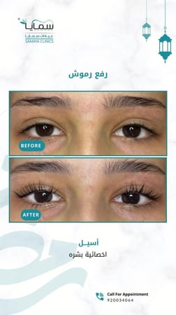 *رفع رموش ( lash lift) - عدد محدود-