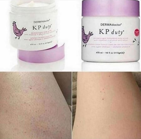مقشر جلد الدجاجة من ديرما دكتور DERMAdoctor KP Duty Dermatologist Formulated Body Scrub