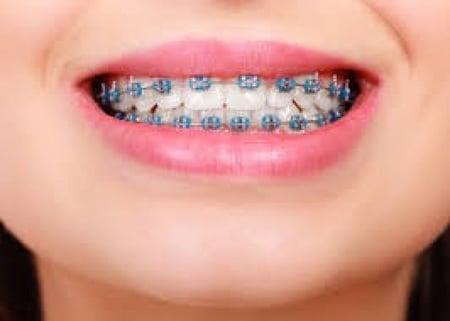 50لفه بالجمله مطاط مكس بكج توفير للتقويم منفصل مع هديه كود خصم