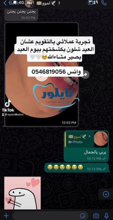 فكين تقويم زينه متصل تركيب غراء