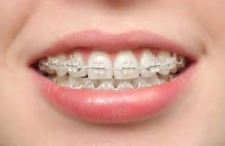 50لفه بالجمله مطاط مكس بكج توفير للتقويم منفصل مع هديه كود خصم