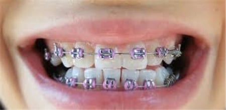 50لفه بالجمله مطاط مكس بكج توفير للتقويم منفصل مع هديه كود خصم