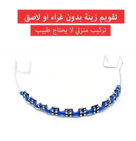 تقويم اسنان تركيب بدون غراء مع هديه من المتجر