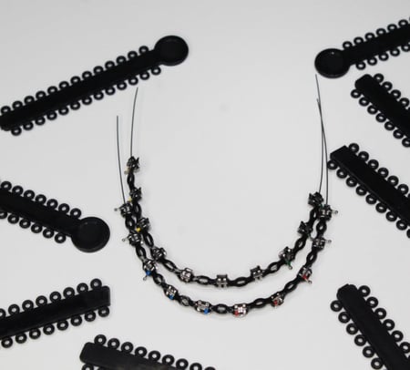 فكين تقويم زينه متصل تركيب غراء