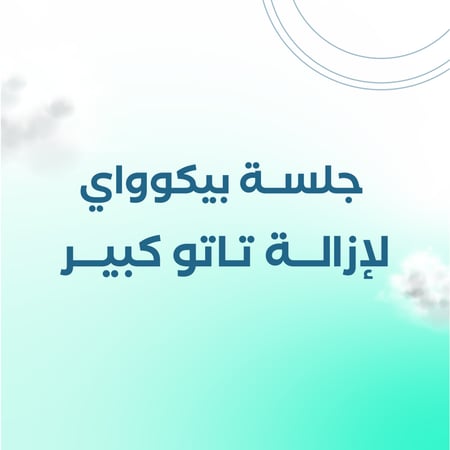 جلسة بيكو واي لازالة التاتو كبير