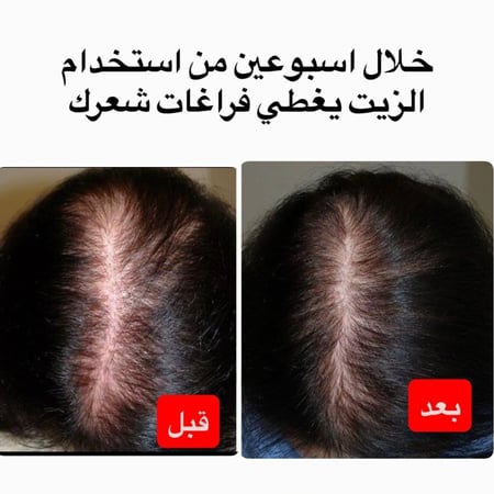 علبتين +علبه مجانا من خلطة زيت التطويل والتكثيف