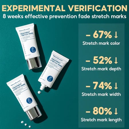 كريم فيتامين e وحمض الاسكوربيك ، هيالورونيك مزيل علامات التمدد إصلاح البشرة  لوشن تبييض وشد مغذي ، كريم مكافحة علامات تمدد الجلد الجديده والقديمة