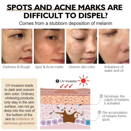 تونر تبييض ألفا أربوتين نياسيناميد يقلل من البقع الداكنة والنمش والتصبغ ويرطب الوجه