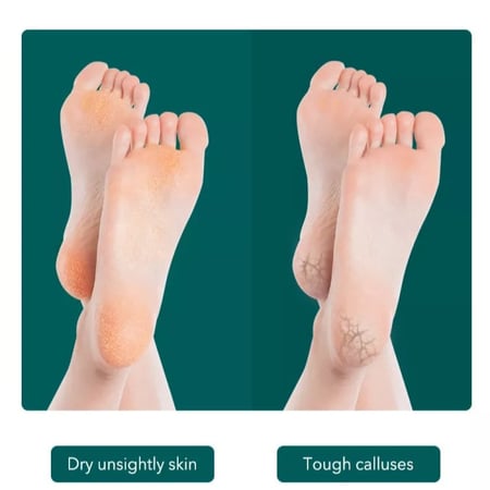 باديكير العناية بالقدم مبرد مكشط القدم