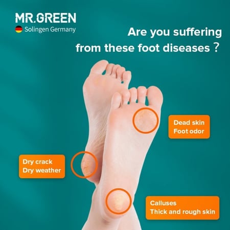 باديكير العناية بالقدم مبرد مكشط القدم