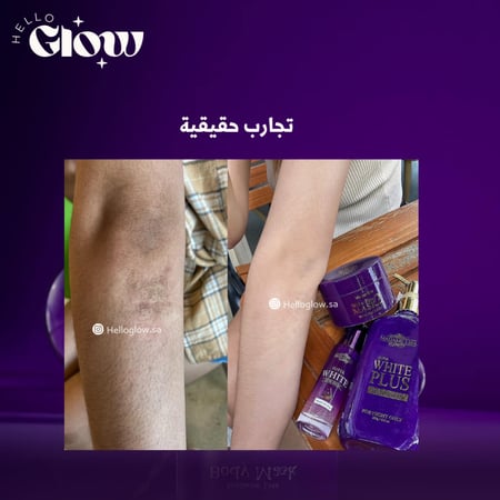 ماسك التفتيح مدام ليزا وايت بلس - Madame Lisa White Plus Mask 2