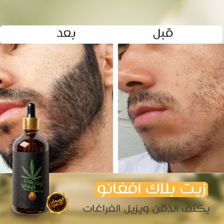 علبتين بلاك افغانو (عرض خاص)