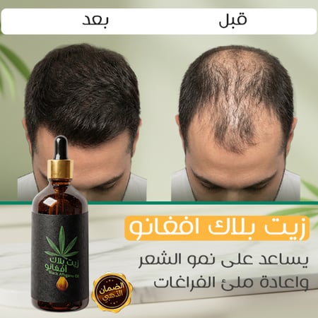 علبتين بلاك افغانو (عرض خاص)