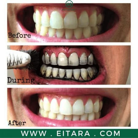 مسحوق الفحم لتبييض الأسنان من ليزر وايت - 20جرام