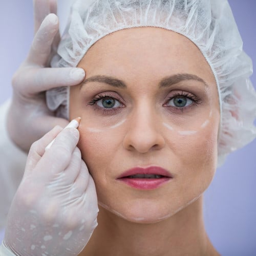 3 خيوط لشد الوجه