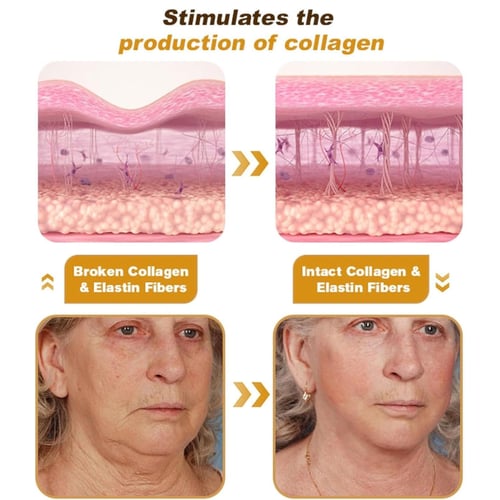 اوهو كريم البوتوكس بخلاصة سم النحل لشد البشرة ومقا...