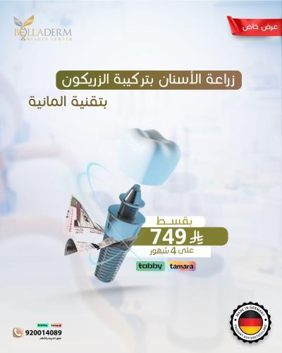 عرض زراعة الاسنان