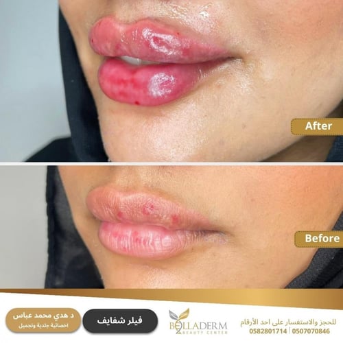 حجز استشارة مع د. هدى عباس