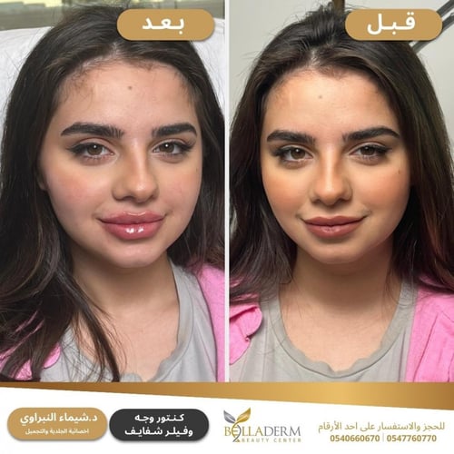 حجز استشارة مع د.شيماء نبراوي