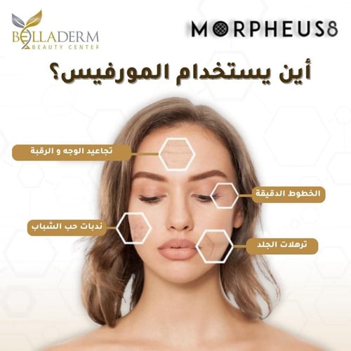 جلسة مورفيس للوجه