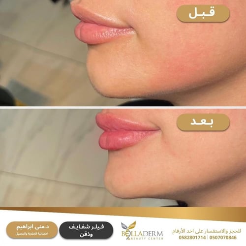 حجز استشارة مع د. منى ابراهيم