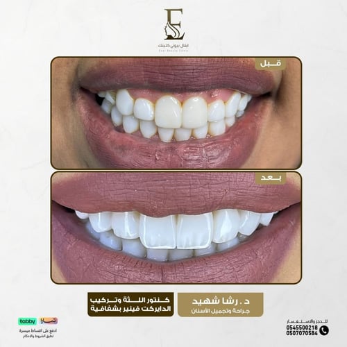 حجز الاستشارة مع د.رشا شهيد طبيب أسنان