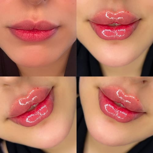 حجز استشارة مع د.ولاء محمود