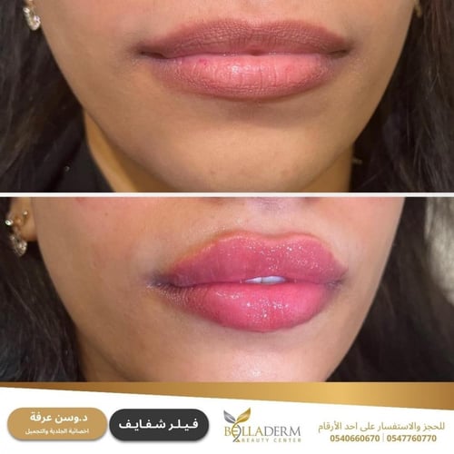 حجز استشارة مع د.وسن عرفة