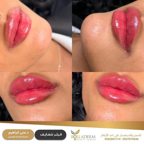 حجز استشارة مع د. منى ابراهيم
