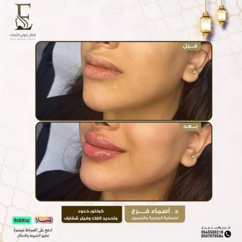 حجز استشارة مع د.اسماء فرج