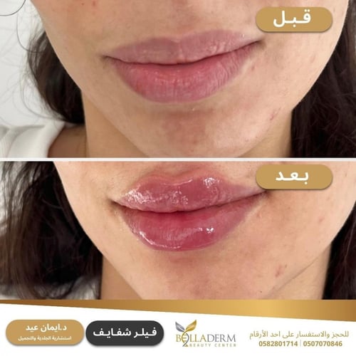 حجز استشارة مع الاستشارية د. ايمان عيد