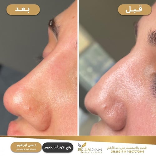 حجز استشارة مع د. منى ابراهيم