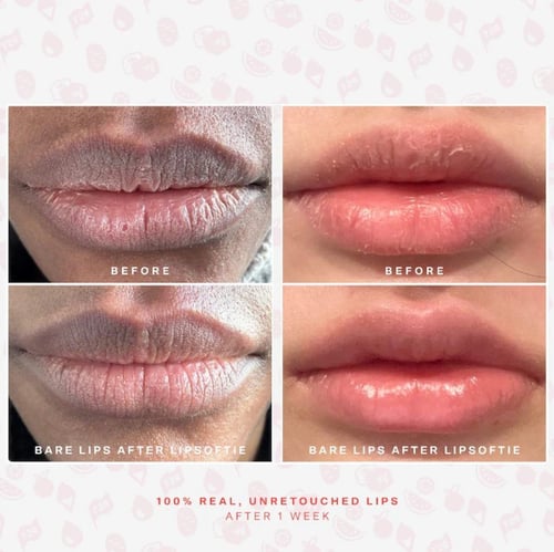 Tower 28 Beauty LipSoftie Hydrating Tinted Lip Tre...