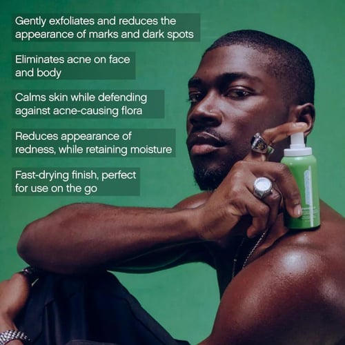 Topicals Clearly Clarifying & Calming Mist For Acn...