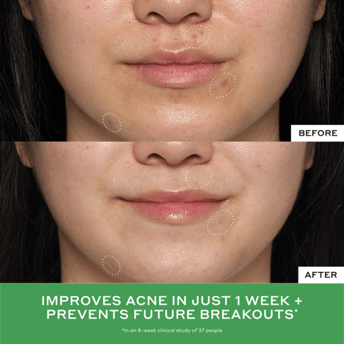 OLEHENRIKSEN Detox Drops 2% Salicylic Acid Toner