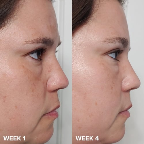 Paula’s Choice Skin Perfecting 2% BHA Liquid Exfol...