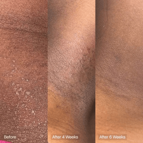 Topicals Faded Brightening & Cleansing Body Bar fo...