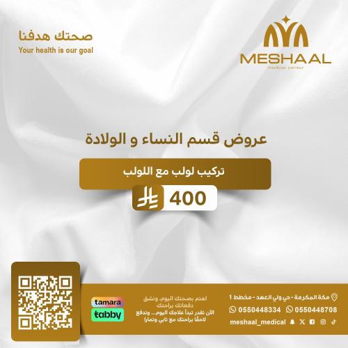 تركيب لولب مع اللولب