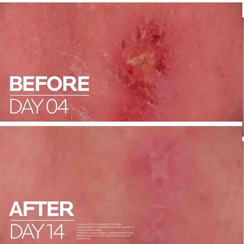 لاروش بوزيه سيكابلاست بوم بي 5