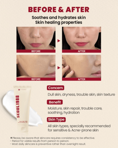 كي سيكرت سيول 1988 كريم بخلاصة موسين الحلزون 93% +...