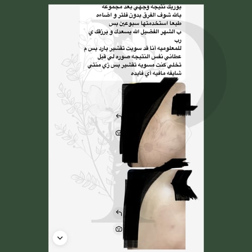 مجموعة تقشير الاحماض الآمن