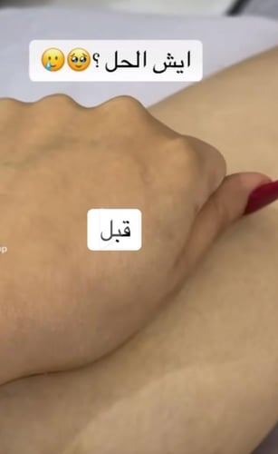 صابونية الاحماض 200غرام