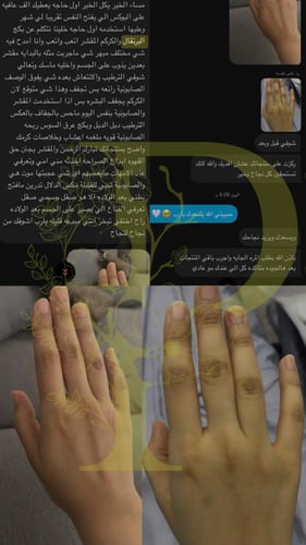 مجموعة التفتيح بالبرتقال1500g