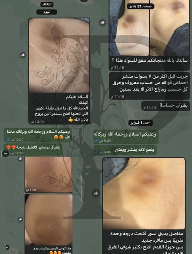 بكج العروس الفاخر+دلكة سودانية