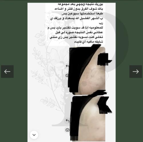 مجموعة مقشر الفلتر الاحماض الآمن حجم مني للوجة 100غرام (تعبئه)