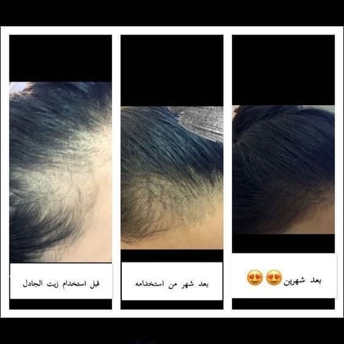 زيت الجادل للشعر 1 + 1 مجانًا