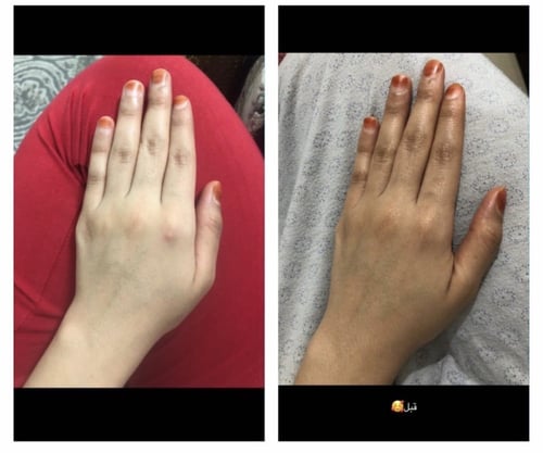 مجموعة العروسة