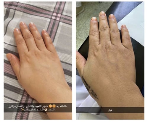 مجموعة العروسة