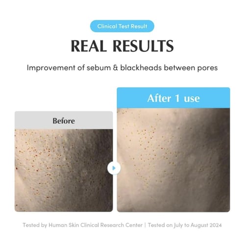 EQQUALBERRY - Swimming Pool Toner Pads إيكوالبيري...