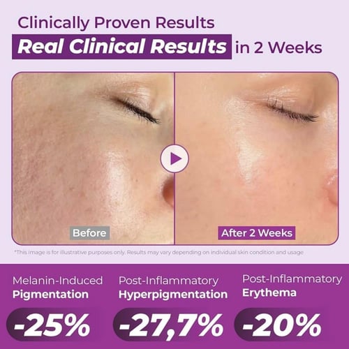 JUMISO - Niacinamide 20% Serum سيروم نياسيناميد 20...